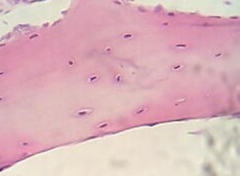 cartridges-living-human-cartilage-grown-on-lab-chip-1