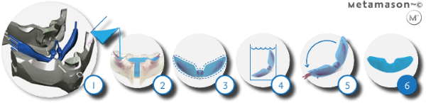 metamason-3d-printed-CPAP-masks-5