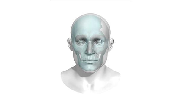 bioarchitects-arcam-announce-fda-approval-3dprinted-titanium-cranial-plate-implants-4