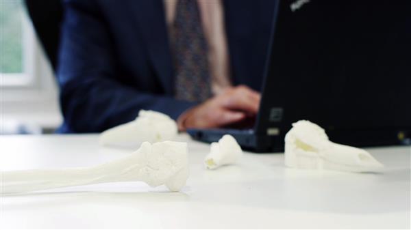 london-private-surgeon-boyd-goldie-adopts-3d-printing-for-surgical-planning-4