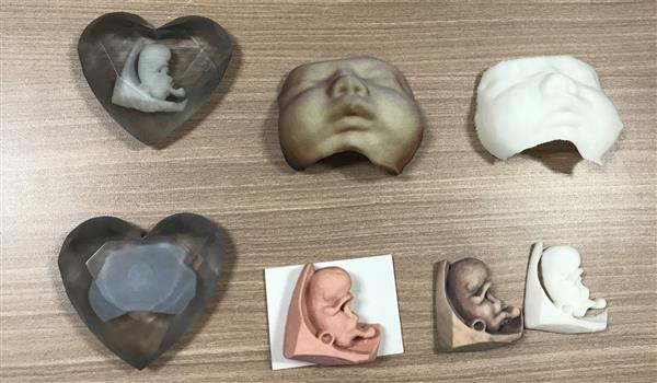 hong-kong-hospital-makes-3d-printed-models-of-foetuses-available-to-expectant-parents-2