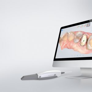AoralScan3 Intra-oral Scan เครื่องสแกนเนอร์ในช่องปาก