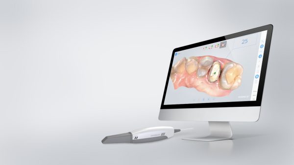 AoralScan2 Intra-oral Scan เครื่องสแกนเนอร์ในช่องปาก - Image 4