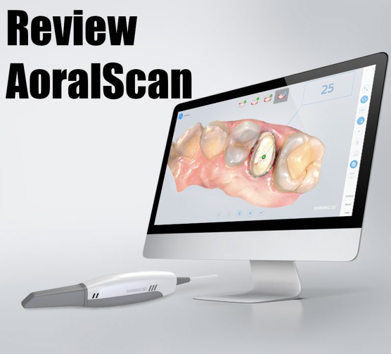 Read more about the article รีวิว AoralScan สแกนเนอร์ทันตกรรม 3D ในช่องปาก