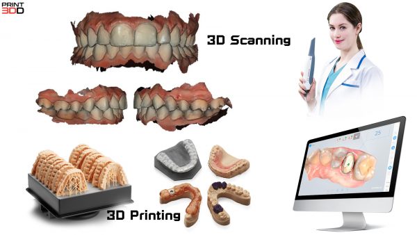 AoralScan3/AoralScan3 Wireless Intra-oral Scan สแกนเนอร์ในช่องปาก เรียวกว่า เร็วกว่า - Image 10