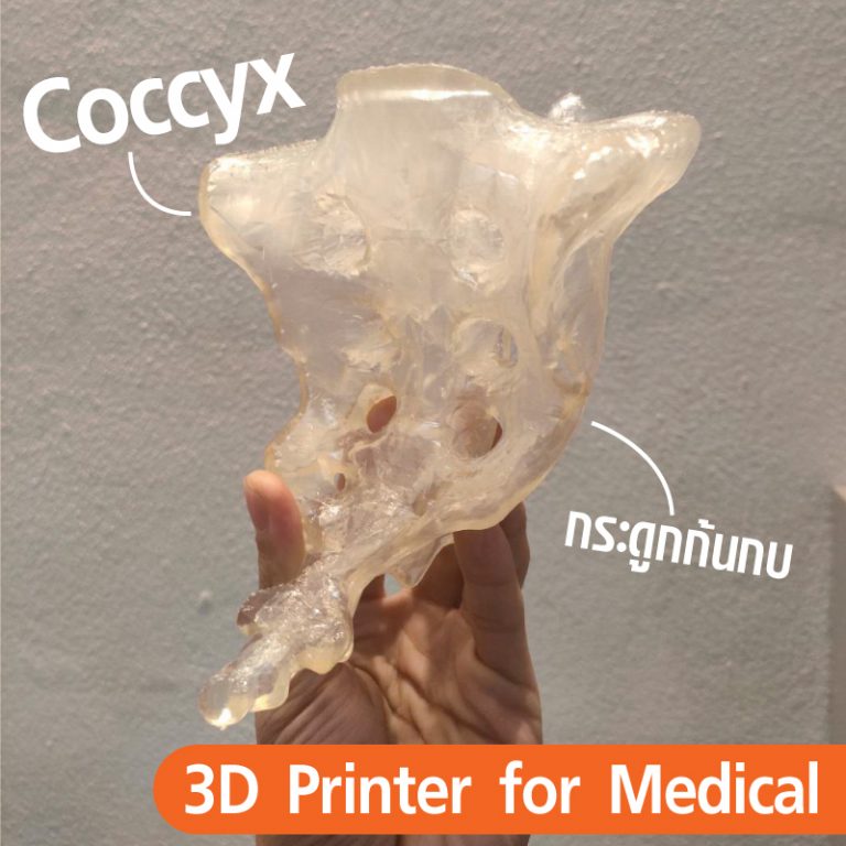 Read more about the article 3D Printing กับ วงการแพทย์ และกระดูกก้นกบ