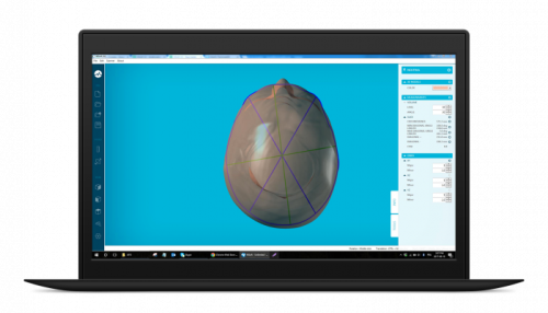 MSoft Body Scan (3D Medical software) - Image 2