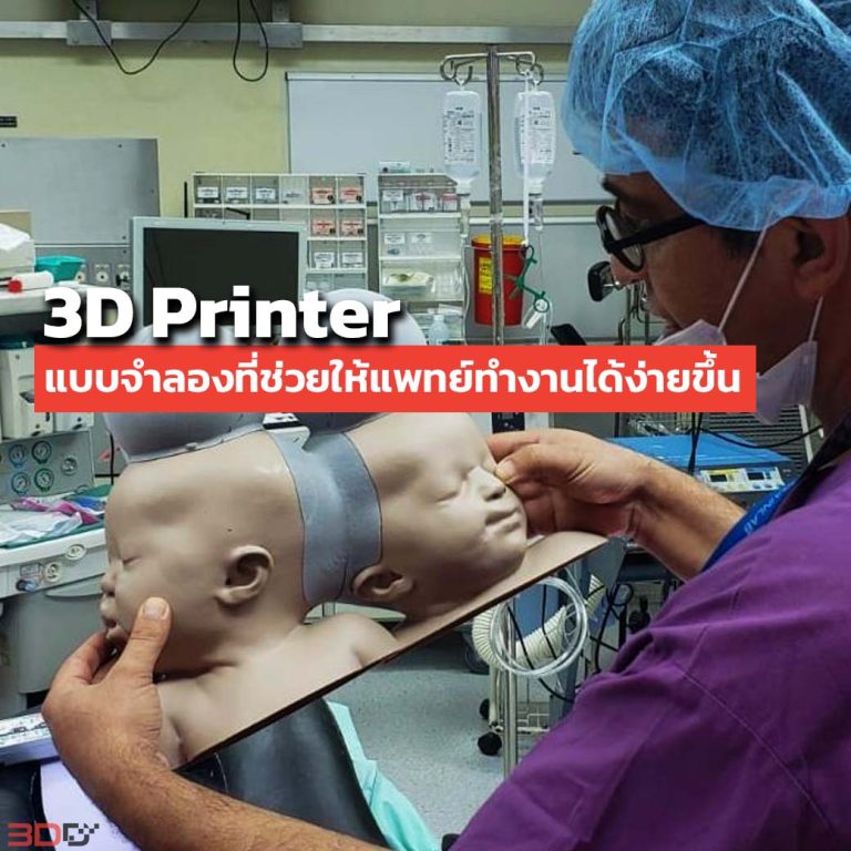 Read more about the article แพทย์ใช้ 3D Printer ทำแบบจำลองทารกฝาแฝดเพื่อใช้ศึกษาในการผ่าตัด