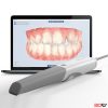 AoralScan3/AoralScan3 Wireless Intra-oral Scan สแกนเนอร์ในช่องปาก เรียวกว่า เร็วกว่า - Image 3
