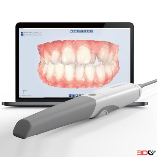 AoralScan3/AoralScan3 Wireless Intra-oral Scan สแกนเนอร์ในช่องปาก เรียวกว่า เร็วกว่า - Image 3