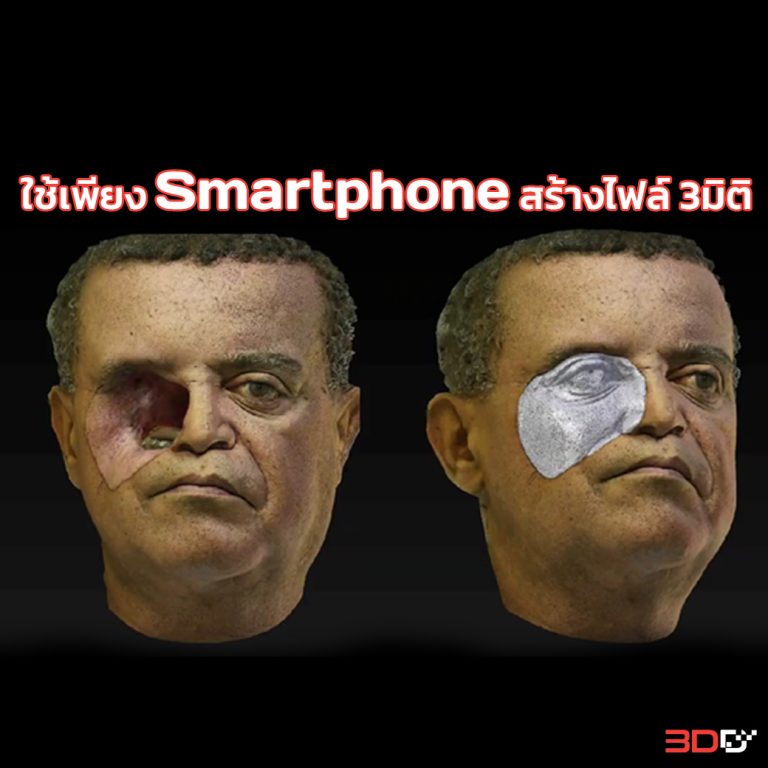 Read more about the article Smartphone ในการสร้างไฟล์ 3มิติเพื่อทำใบหน้าเทียม