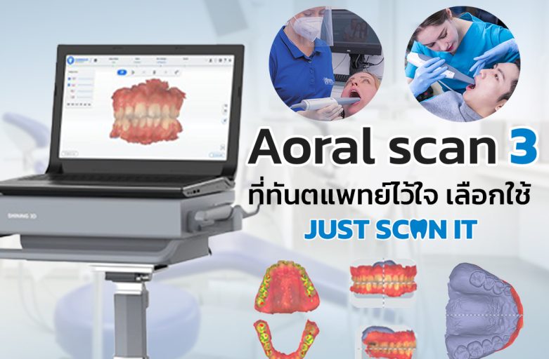 เปิดตัวสแกนเนอร์ในช่องปาก Aoral Scan3 มีอะไรอัพเกรดใหม่บ้าง