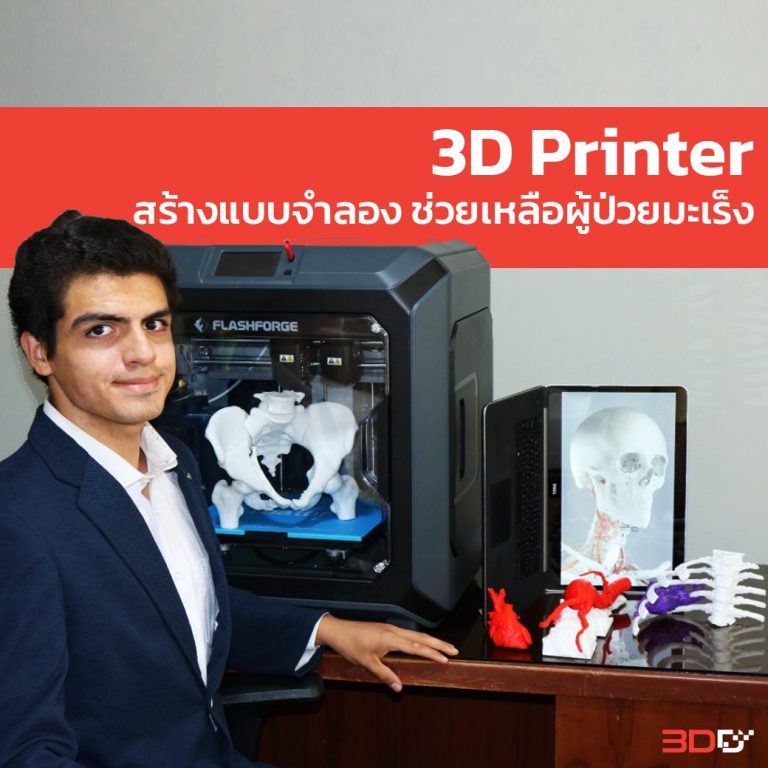 Read more about the article 3D Printer สร้างแบบจำลองเพื่อผ่าตัดช่วยเหลือเด็กผู้ป่วยมะเร็ง