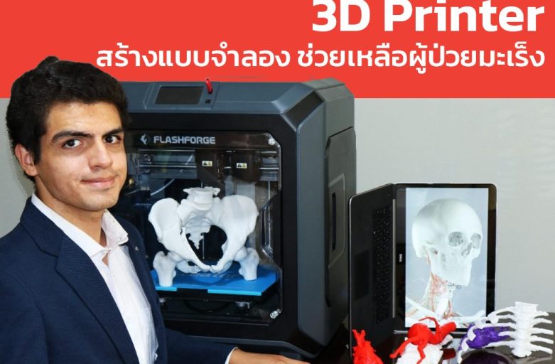 3D Printer สร้างแบบจำลองเพื่อผ่าตัดช่วยเหลือเด็กผู้ป่วยมะเร็ง