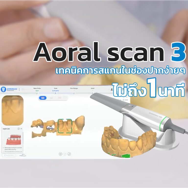 Read more about the article เทคนิคสแกนในช่องปากด้วย Aoral Scan3