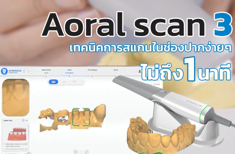 เทคนิคสแกนในช่องปากด้วย Aoral Scan3