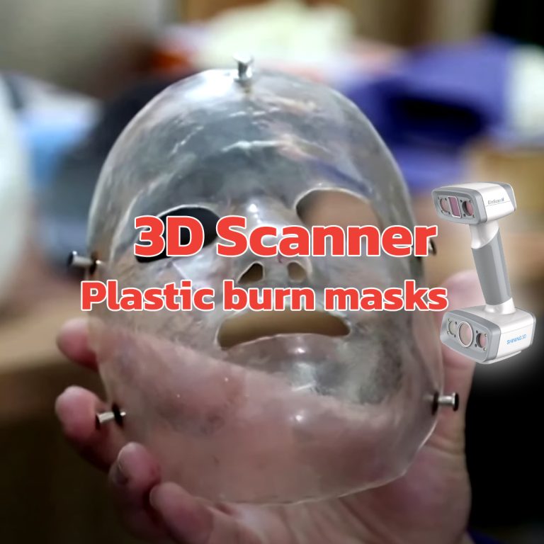 Read more about the article 3D Scanner ในการพิมพ์ใบหน้าเพื่อช่วยเหลือเหยื่อที่ถูกไฟไหม้