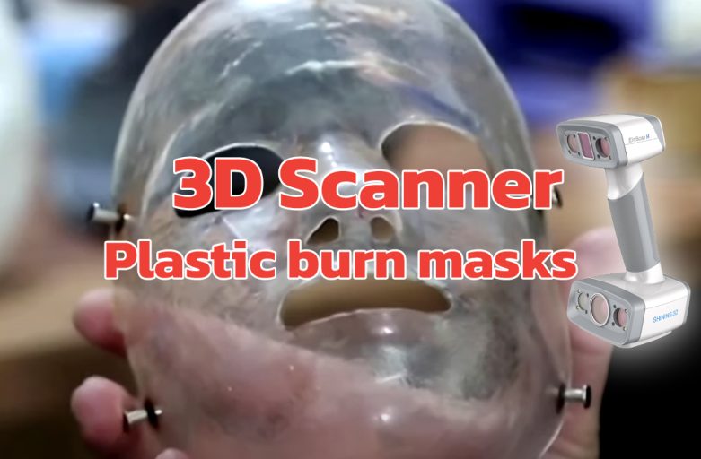 3D Scanner ในการพิมพ์ใบหน้าเพื่อช่วยเหลือเหยื่อที่ถูกไฟไหม้