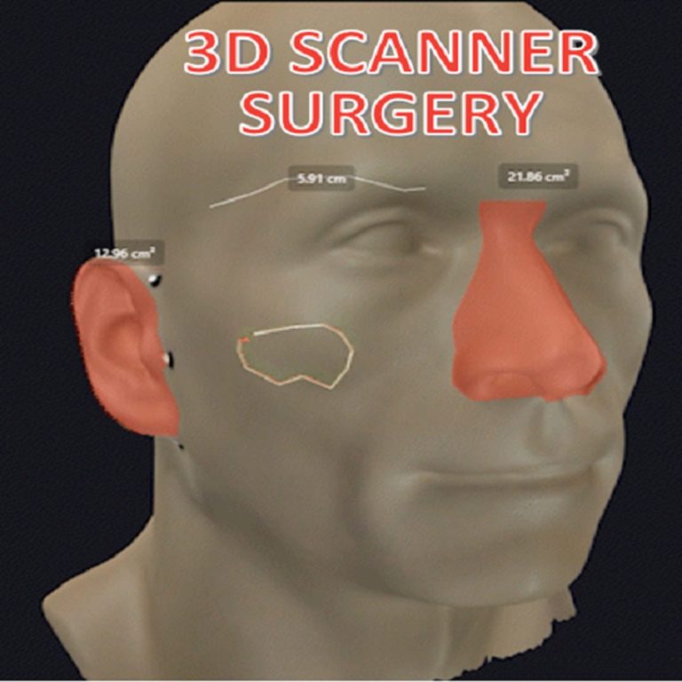 Read more about the article ศัลยกรรมการแพทย์กับ 3D Scanner ช่วยอะไรได้บ้าง