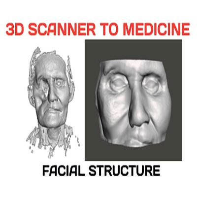 การแพทย์ สร้างโครงหน้าเสมือนจาก 3D Scanner