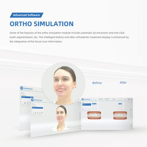 MetiSmile Dental Face 3D Scanner - เครื่องสแกนใบหน้าสำหรับงานทันตกรรม - Image 5