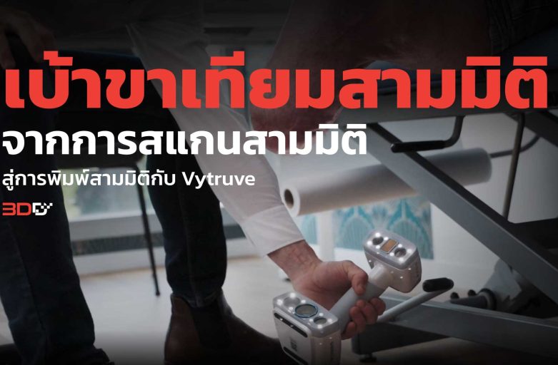 เบ้าขาเทียมสามมิติ จากการสแกนสามมิติสู่การพิมพ์สามมิติกับ Vytruve