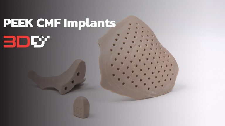 Read more about the article PEEK CMF Implants ขยายตัวเลือกวัสดุสำหรับการศัลยกรรมเฉพาะบุคคล